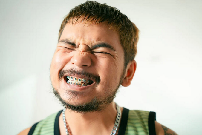 braces
