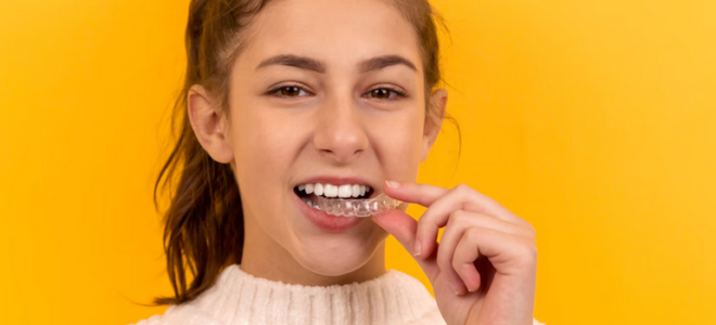 Achieve the Perfect Smile: A Beginner’s Guide to Clear Aligner Maintenance
